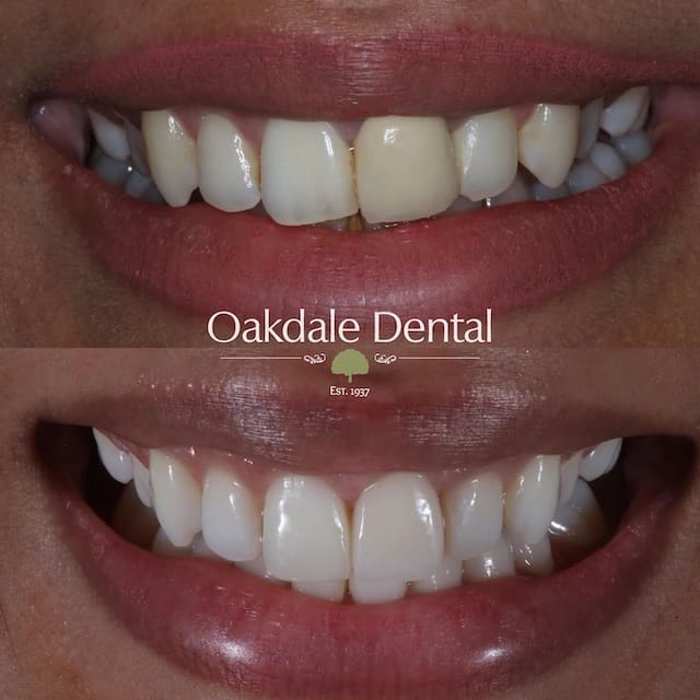 $variable({"type":"content","value":{"name":"post_title","settings":{"before":"","after":""}}})$