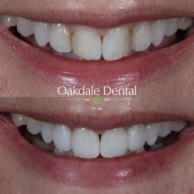 $variable({"type":"content","value":{"name":"post_title","settings":{"before":"","after":""}}})$