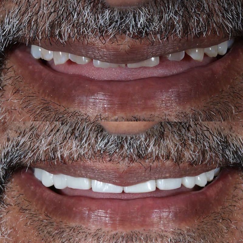 $variable({"type":"content","value":{"name":"post_title","settings":{"before":"","after":""}}})$