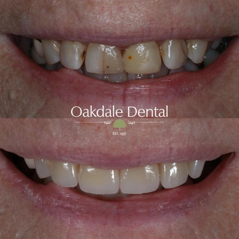 $variable({"type":"content","value":{"name":"post_title","settings":{"before":"","after":""}}})$