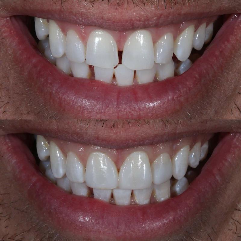 $variable({"type":"content","value":{"name":"post_title","settings":{"before":"","after":""}}})$