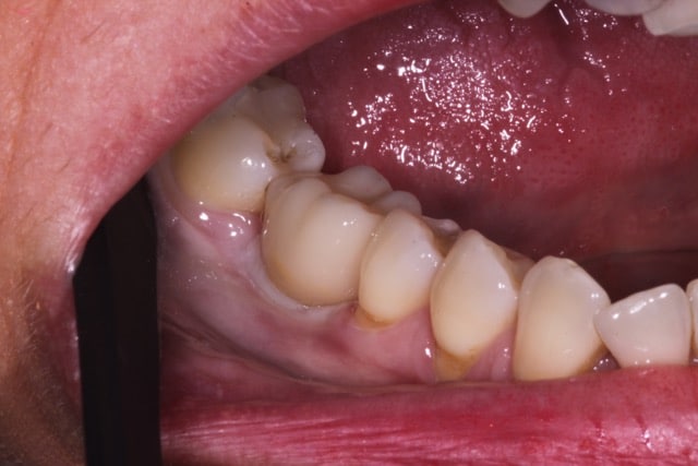 $variable({"type":"content","value":{"name":"post_title","settings":{"before":"","after":""}}})$ $variable({"type":"content","value":{"name":"post_title","settings":{"before":"","after":""}}})$