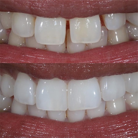 Smiles-m $variable({"type":"content","value":{"name":"post_title","settings":{"before":"","after":""}}})$