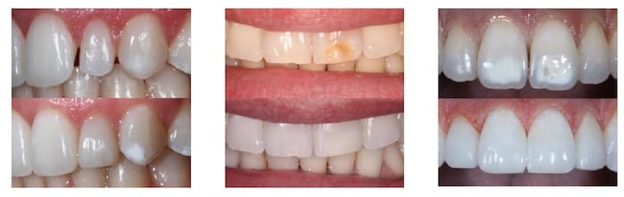 $variable({"type":"content","value":{"name":"post_title","settings":{"before":"","after":""}}})$