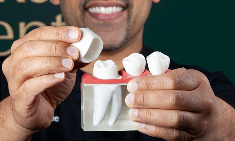 crowns CEREC_by_Sirona