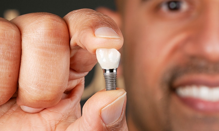 implant-d $variable({"type":"content","value":{"name":"post_title","settings":{"before":"","after":""}}})$