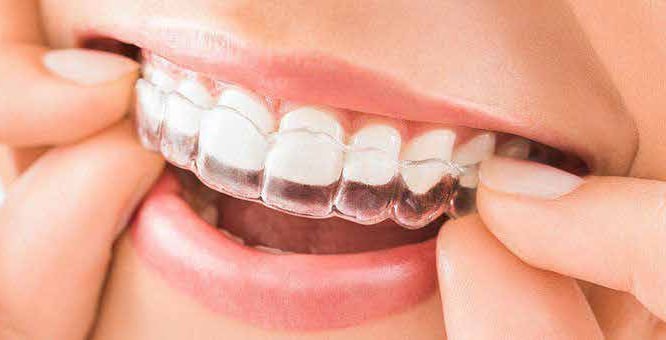 $variable({"type":"content","value":{"name":"post_title","settings":{"before":"","after":""}}})$