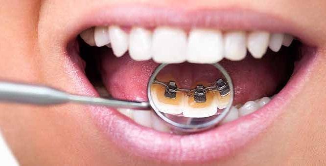 $variable({"type":"content","value":{"name":"post_title","settings":{"before":"","after":""}}})$