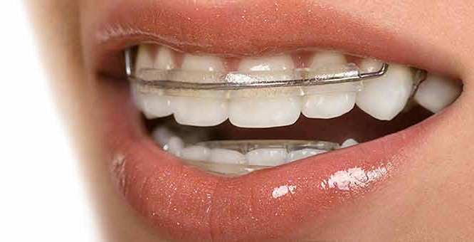 $variable({"type":"content","value":{"name":"post_title","settings":{"before":"","after":""}}})$