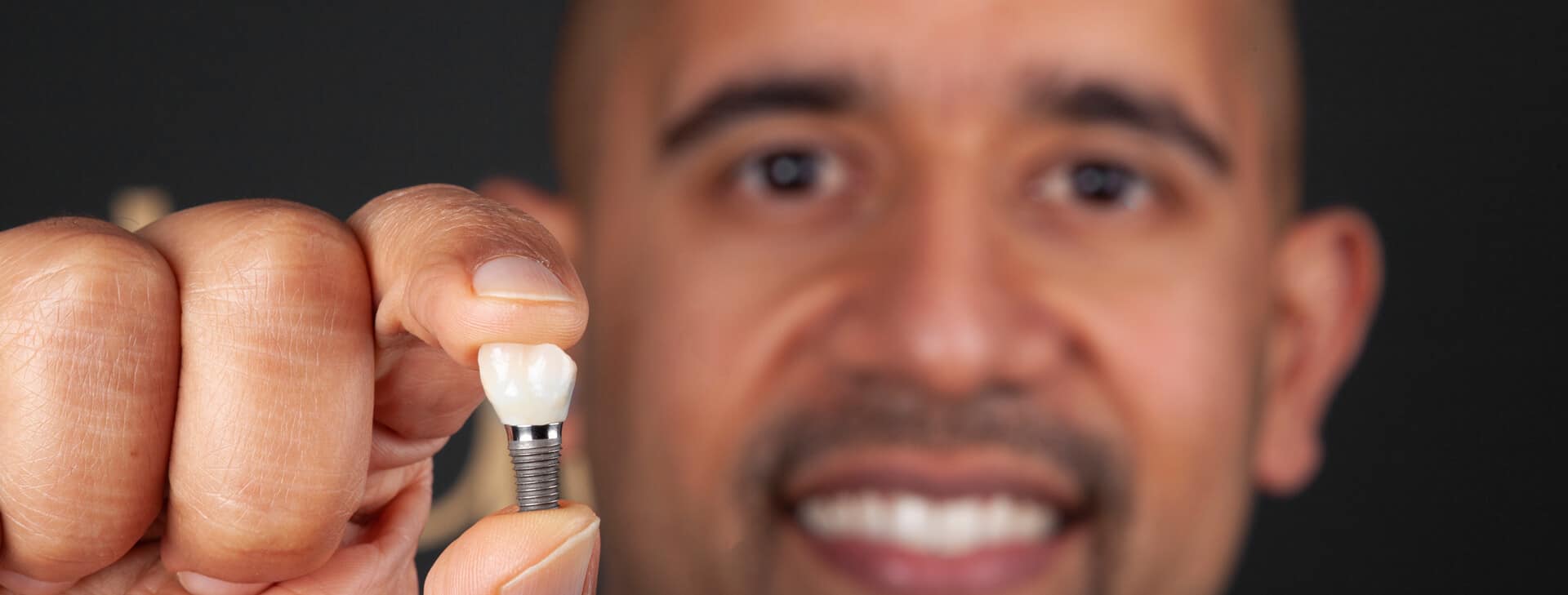 dental-implants-le1 $variable({"type":"content","value":{"name":"post_title","settings":{"before":"","after":""}}})$