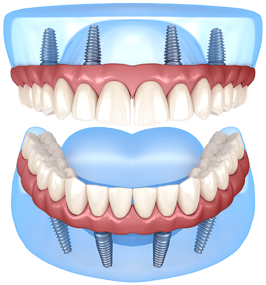 $variable({"type":"content","value":{"name":"post_title","settings":{"before":"","after":""}}})$