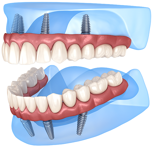 $variable({"type":"content","value":{"name":"post_title","settings":{"before":"","after":""}}})$