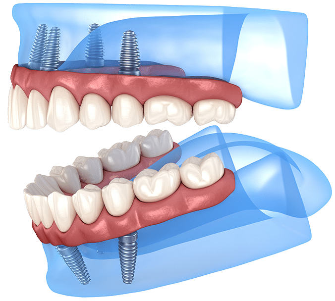 $variable({"type":"content","value":{"name":"post_title","settings":{"before":"","after":""}}})$
