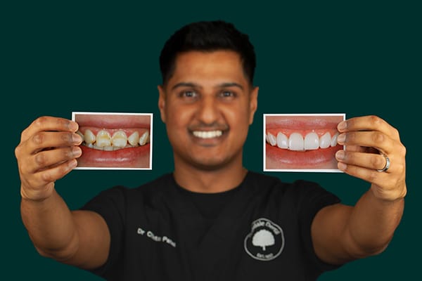 leicester-dentist-m $variable({"type":"content","value":{"name":"post_title","settings":{"before":"","after":""}}})$