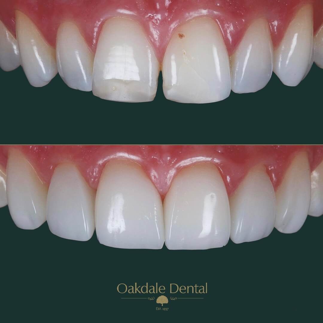 $variable({"type":"content","value":{"name":"post_title","settings":{"before":"","after":""}}})$