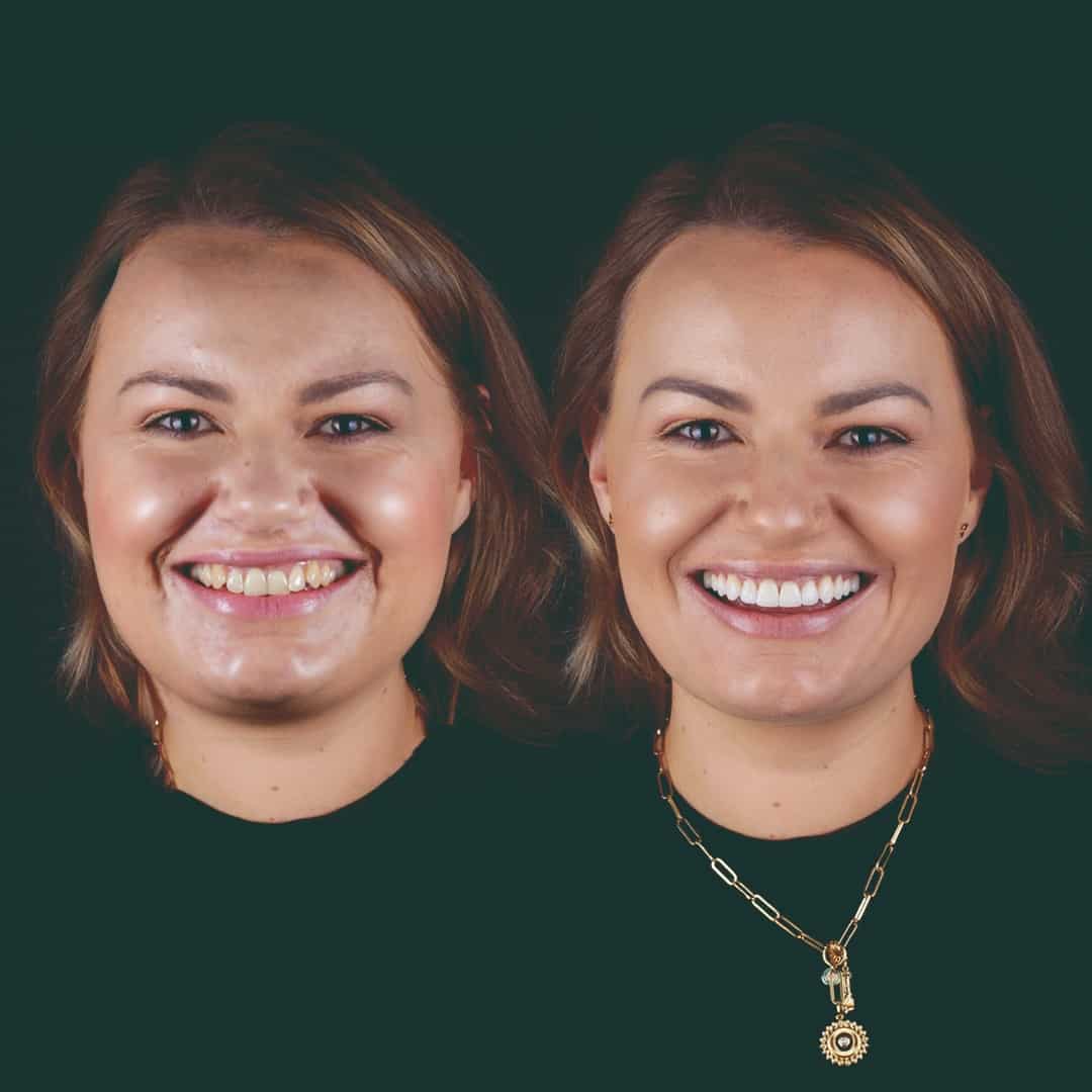 $variable({"type":"content","value":{"name":"post_title","settings":{"before":"","after":""}}})$