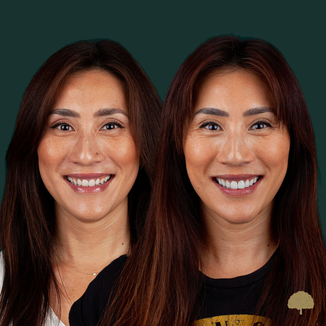 $variable({"type":"content","value":{"name":"post_title","settings":{"before":"","after":""}}})$