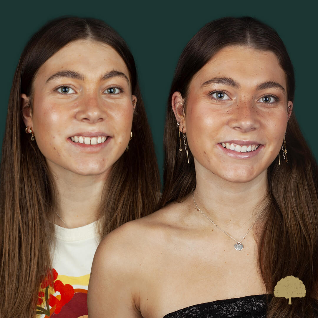 $variable({"type":"content","value":{"name":"post_title","settings":{"before":"","after":""}}})$