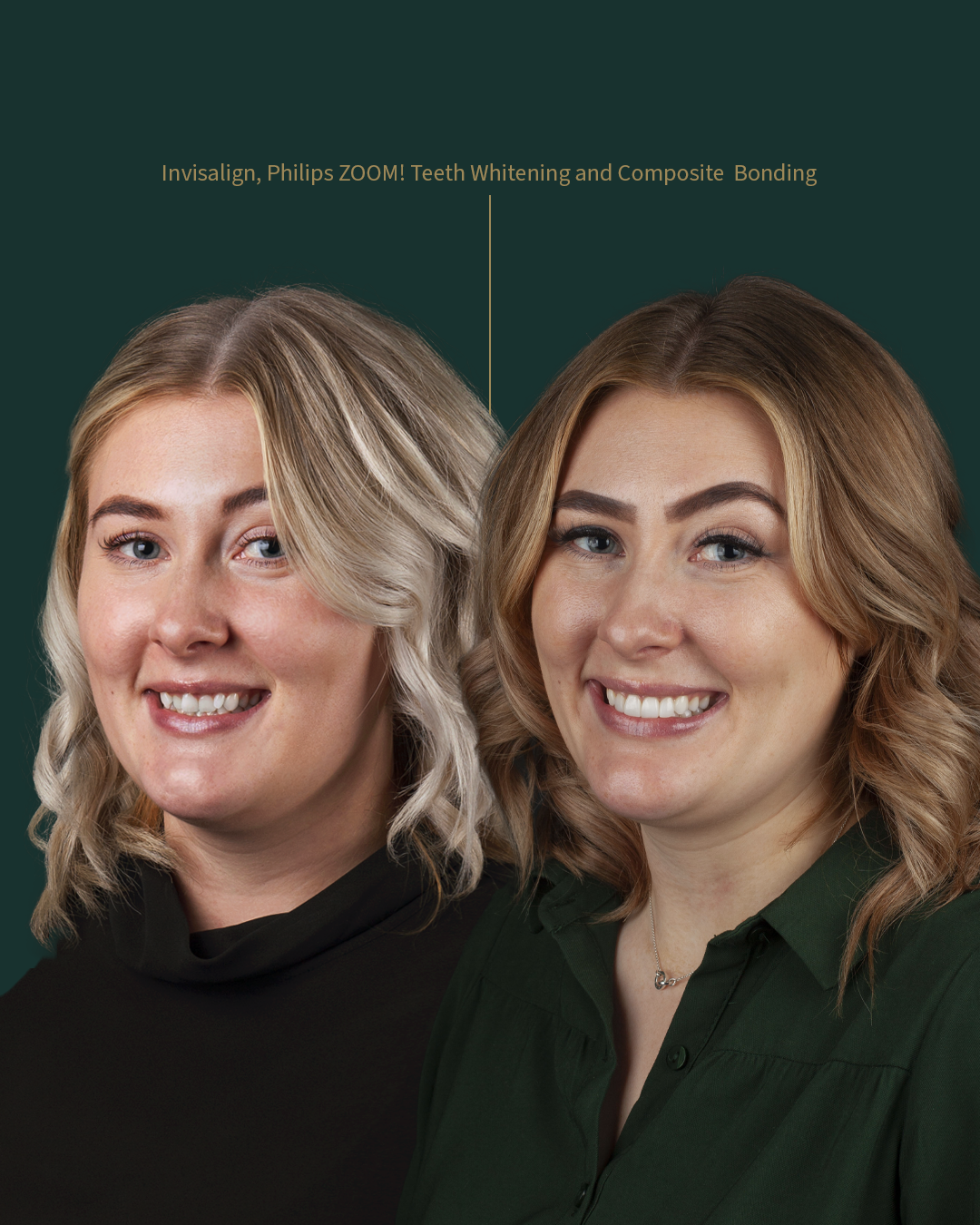 $variable({"type":"content","value":{"name":"post_title","settings":{"before":"","after":""}}})$