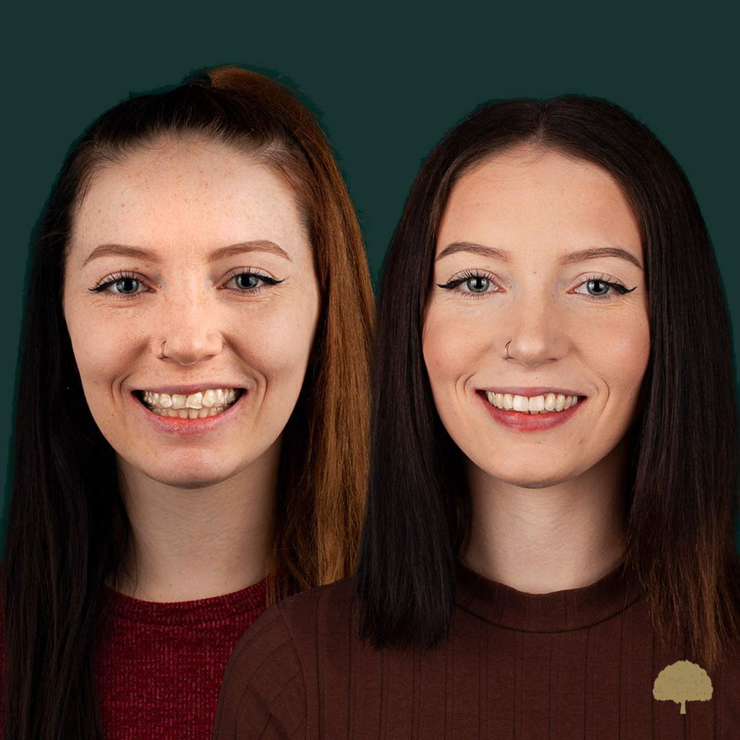 $variable({"type":"content","value":{"name":"post_title","settings":{"before":"","after":""}}})$