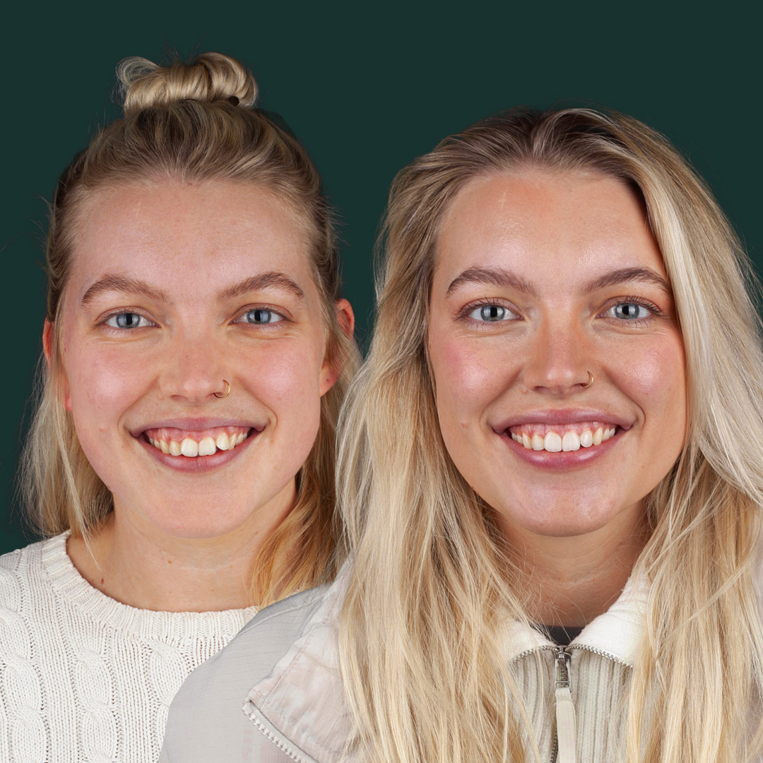 $variable({"type":"content","value":{"name":"post_title","settings":{"before":"","after":""}}})$