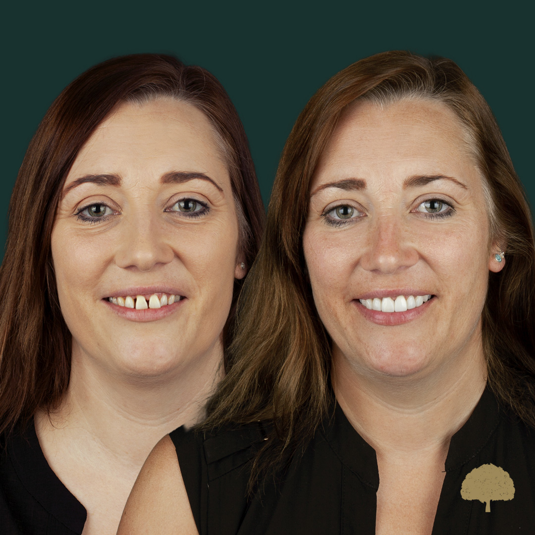 $variable({"type":"content","value":{"name":"post_title","settings":{"before":"","after":""}}})$