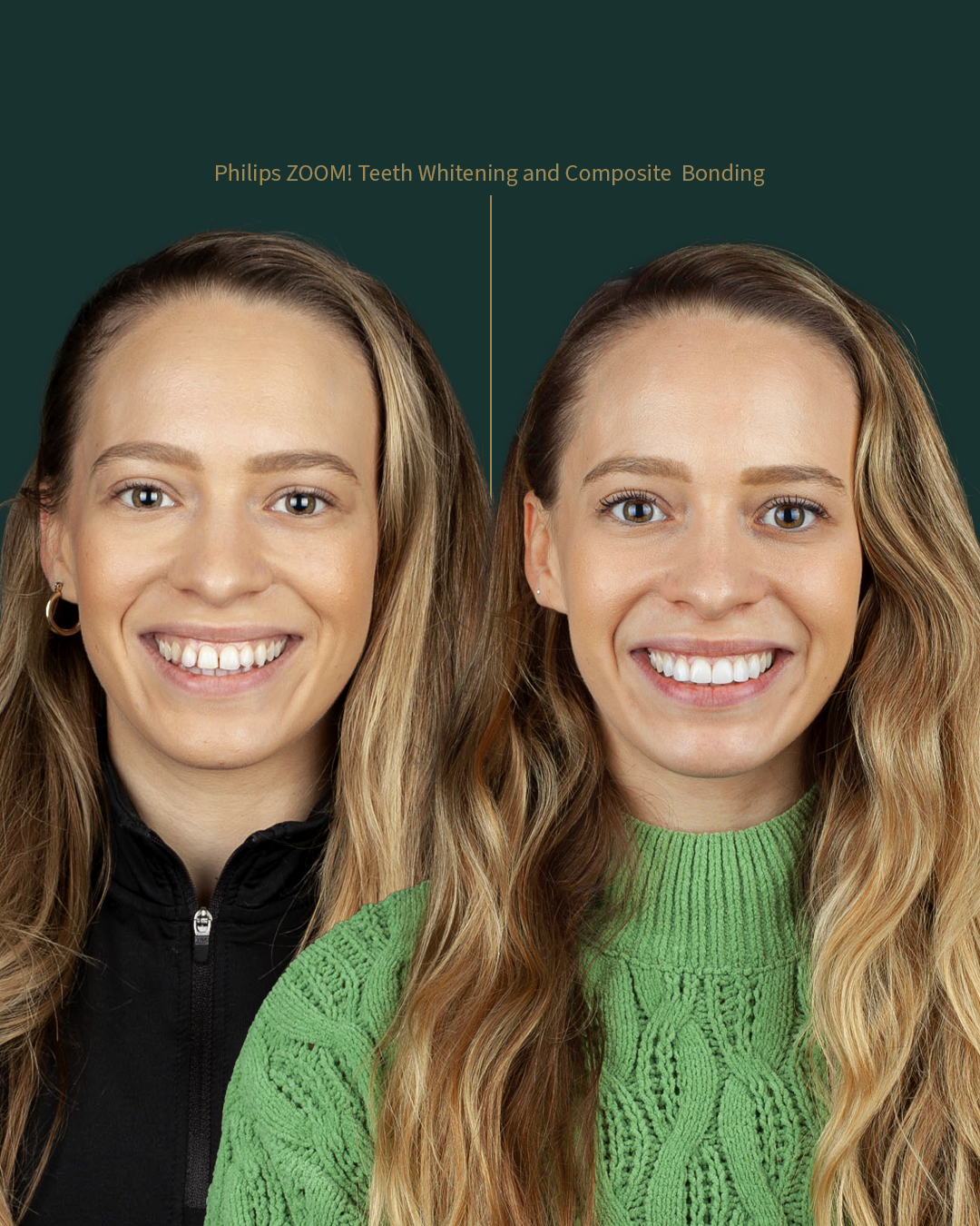 $variable({"type":"content","value":{"name":"post_title","settings":{"before":"","after":""}}})$