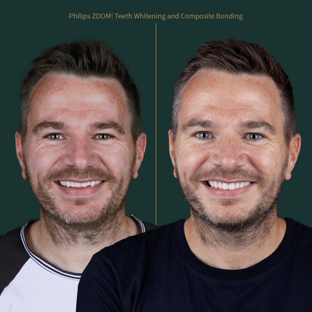 $variable({"type":"content","value":{"name":"post_title","settings":{"before":"","after":""}}})$