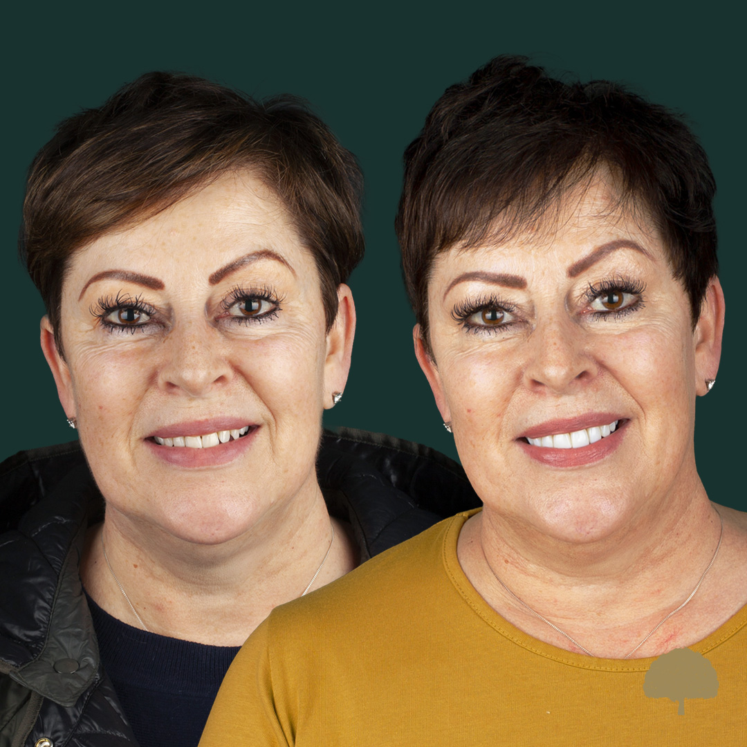 $variable({"type":"content","value":{"name":"post_title","settings":{"before":"","after":""}}})$