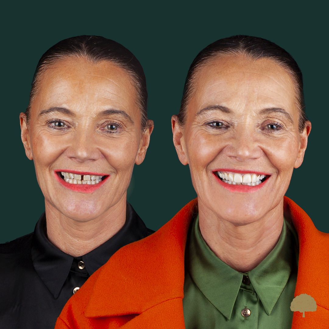 $variable({"type":"content","value":{"name":"post_title","settings":{"before":"","after":""}}})$