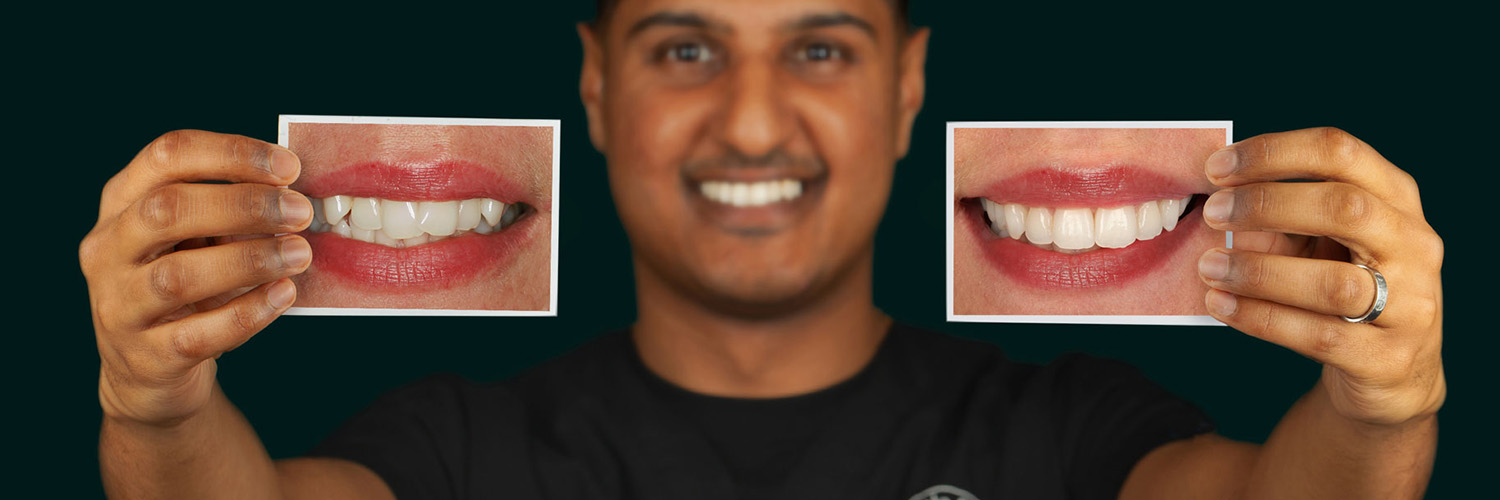 $variable({"type":"content","value":{"name":"post_title","settings":{"before":"","after":""}}})$