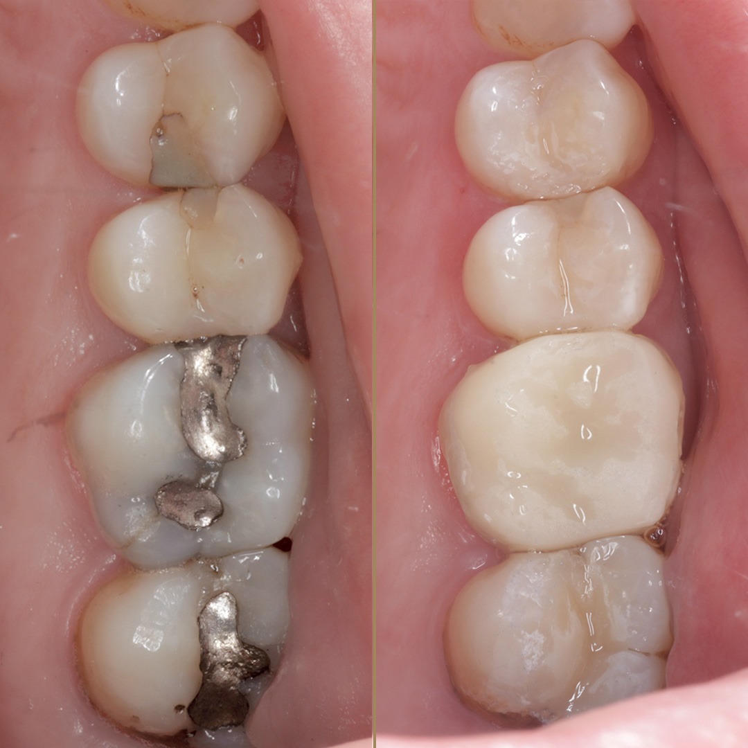 $variable({"type":"content","value":{"name":"post_title","settings":{"before":"","after":""}}})$