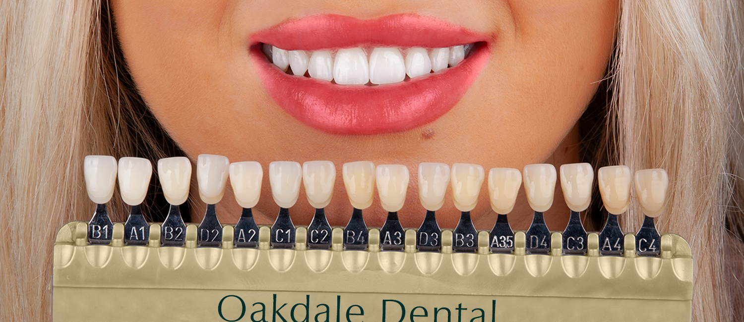 Whitening-hero-banner-1 $variable({"type":"content","value":{"name":"post_title","settings":{"before":"","after":""}}})$